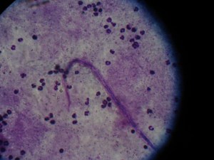 The tail of the "worm" in the blood film.