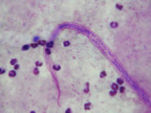 Higher resolution image of the tail of a second "worm".