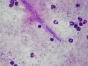 Higher resolution of the head of another "worm".