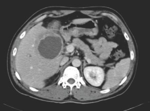 CT image of the abdomen