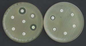 Antimicrobial susceptibility results of the patient with VAP (courtesy of A/Prof Koh TH)