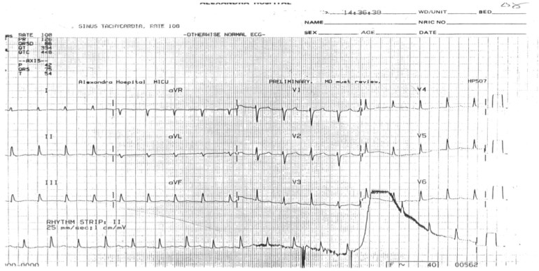 ECG Quiz.