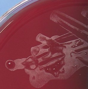 Blood agar plate showing very small microscopic whitish colonies.